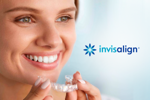 Ortodontia Invisalign – Clínica Fatarelli Odontologia Integrada