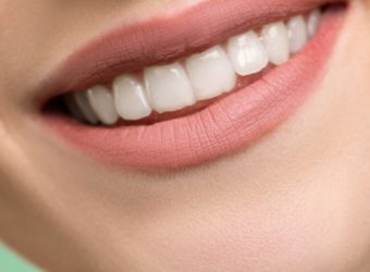 Desmineralização dos dentes: por que ela ocorre?